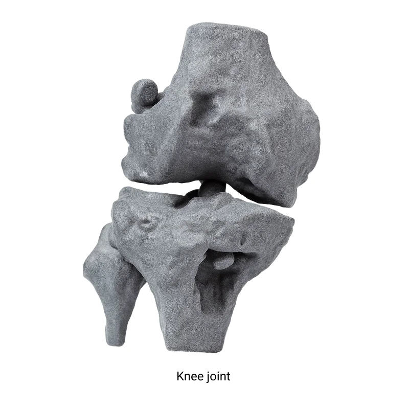 3D printed anatomical knee joint model