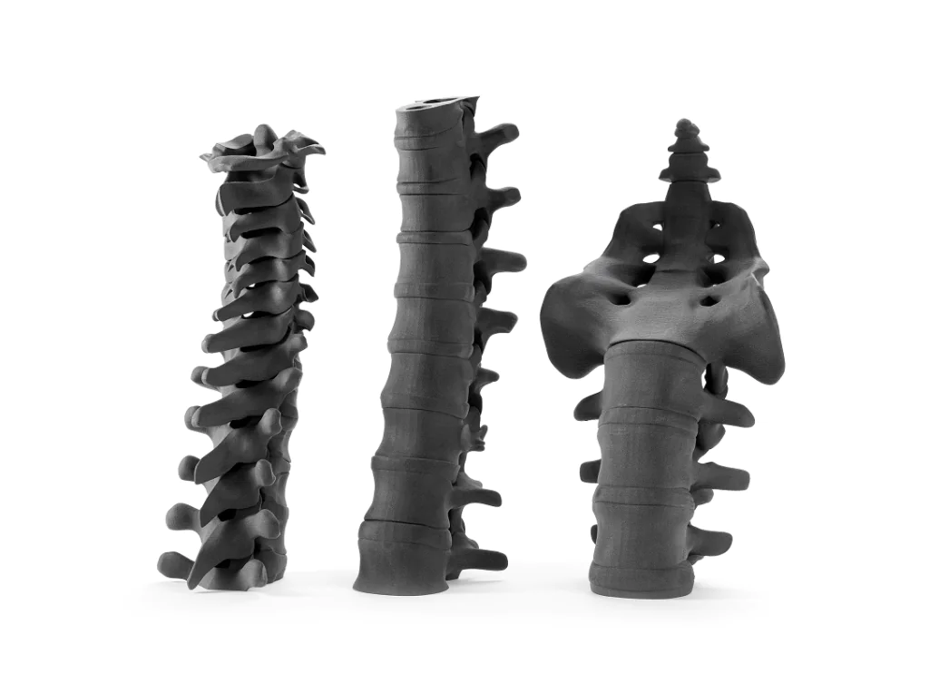 3D printed spine models showcasing anatomical structures
