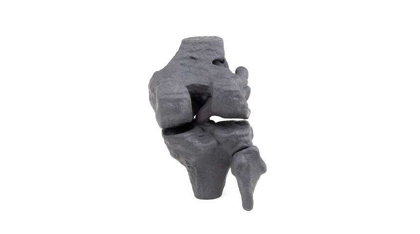 3D printed knee joint model